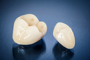 Two dental crowns sitting next to each other